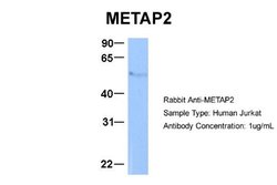 Methionine Aminopeptidase 2/METAP2 Rabbit anti-Human, Polyclonal, Novus Biologicals 0.1 mL | Buy Online | Novus Biologicals | Fisher Scientific